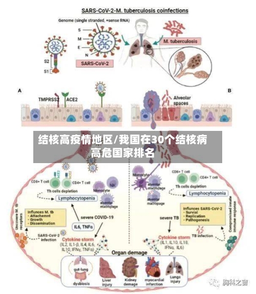 结核高疫情地区/我国在30个结核病高危国家排名